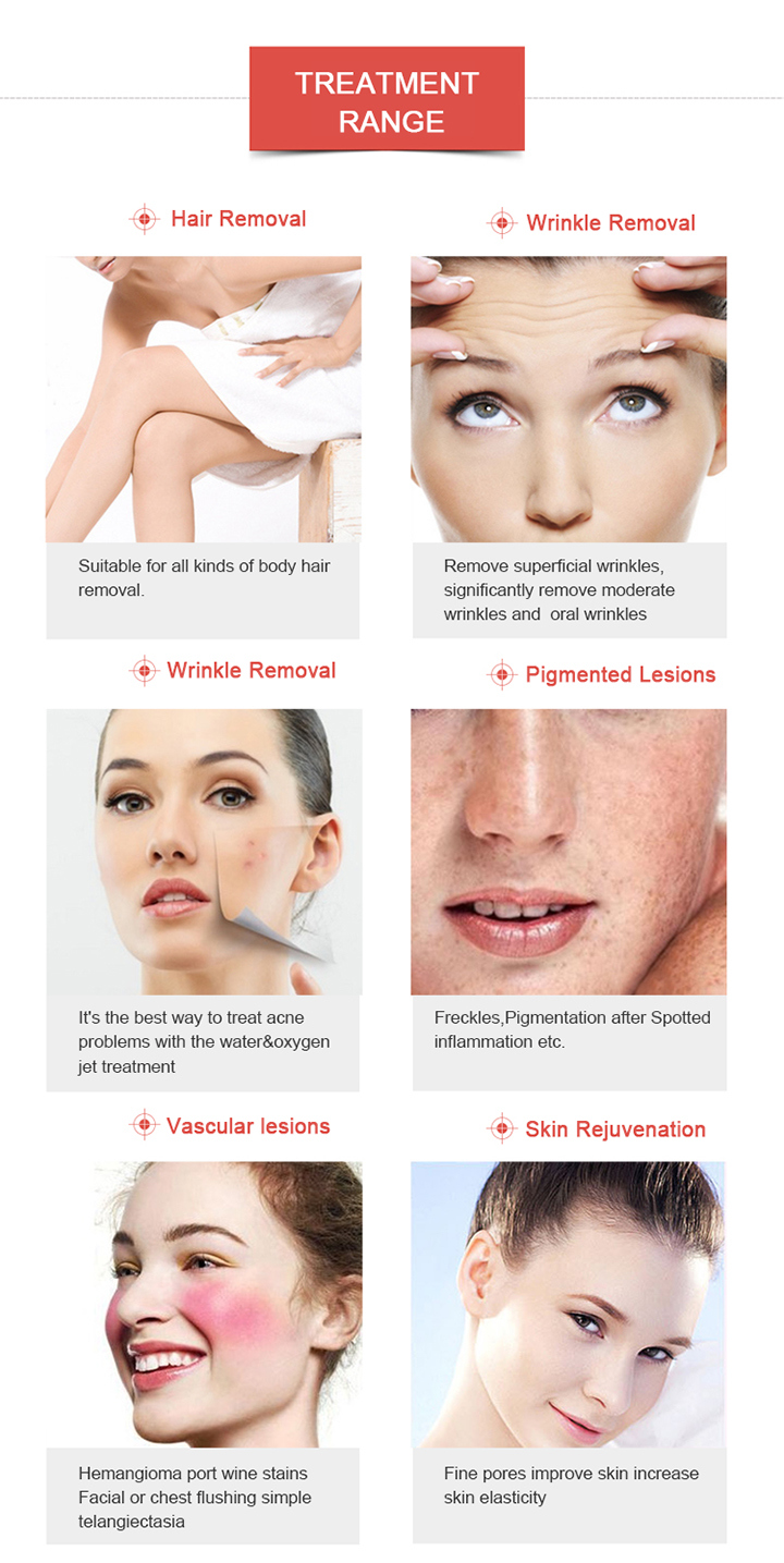 Ce Approved IPL Opt for Hair Removal and Skin Rejuvenation