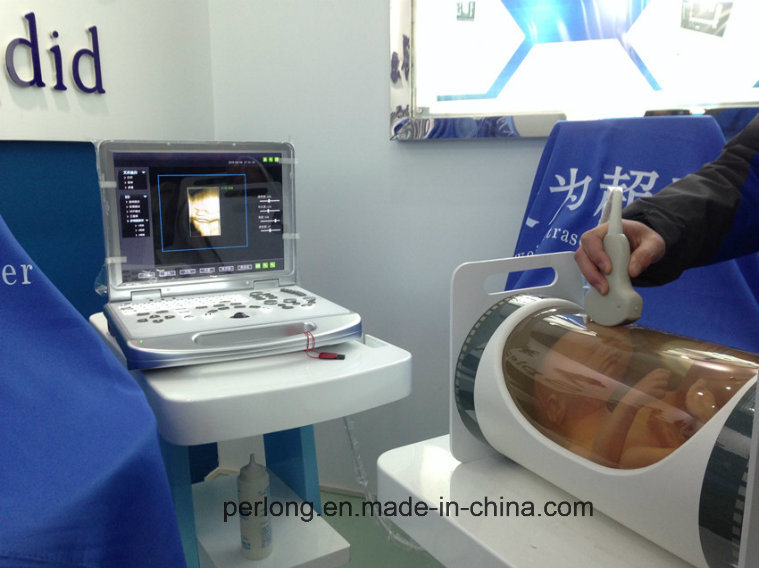 Pl-C60 Plus Medical Portable Ultrasound Scanner, 3D Color Doppler Machine
