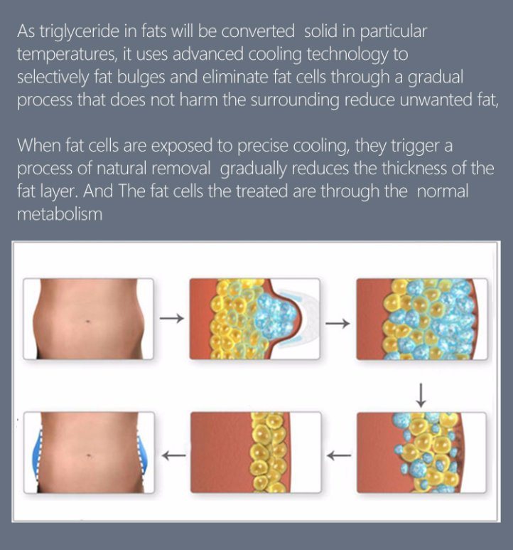 Portable Double Channel Cryolipolysis Slimming Machine with Double Chine Handle