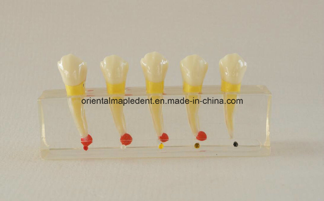 Dental Teeth Teaching Model for Endodontic Treatment