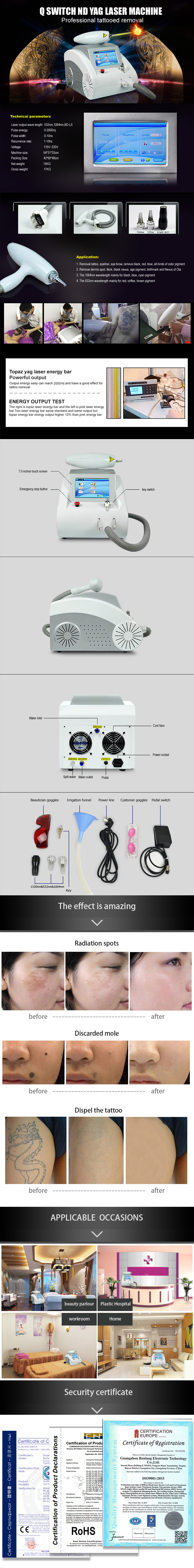 China Supplier Q-Switch ND YAG Laser Tattoo Removal Machine