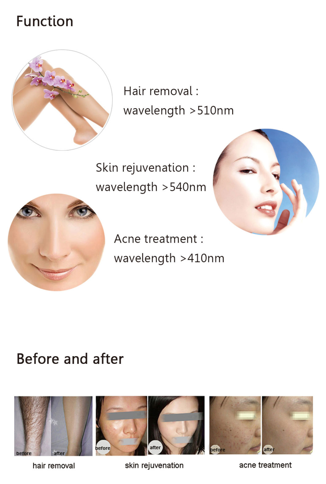 IPL RF Hair Removal Machine and Reducing Pigment Machine