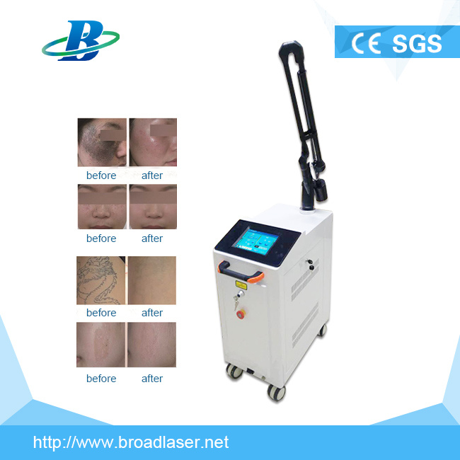 Professional Q Switch ND YAG Laser Tattoo Removal Beauty Machine