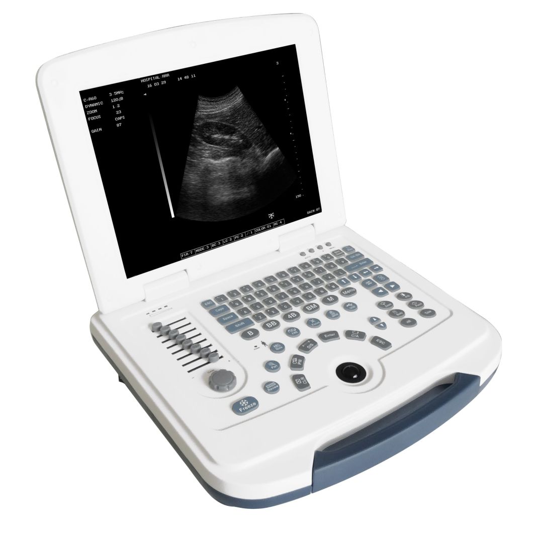 Clear Image and Convenient to Operate Full Digital Laptop Black White Ultrasound Scanner Mslpu09