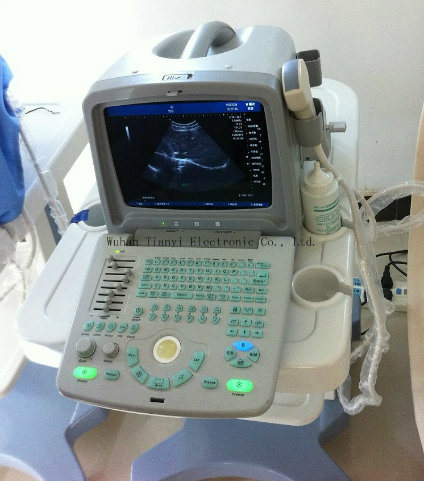 Portable USG Full Digital Ultrasound Scanner for Pregnancy
