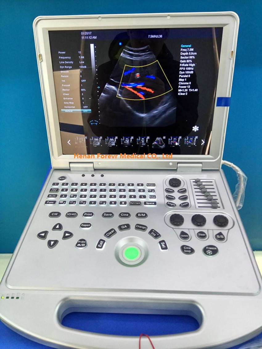 4D Baby Portable Medical Color Doppler Ultrasound Machine