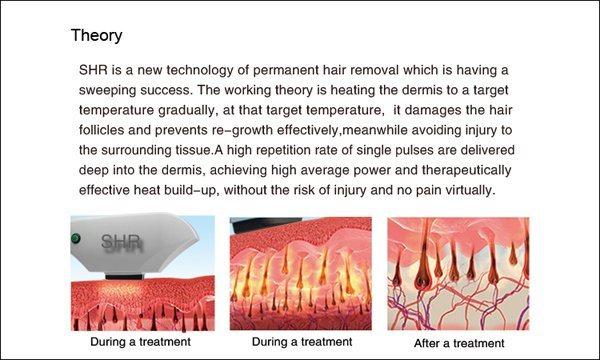 Shr IPL Laser Hair and Wrinkle Remover