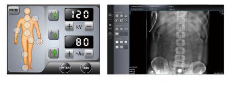 Mobile Digital X-ray Machine with Flat Panel Detector