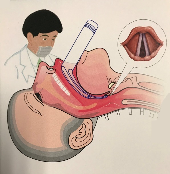 ISO&Ce Approved Disposable Anesthesia Consumables Neonatal Sized Laryngoscope Blade