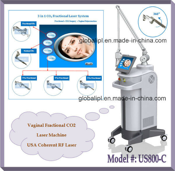 Professional Vaginal Tightening Fractional CO2 Laser