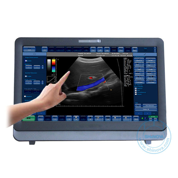 Color Doppler Ultrasound System (Touch Screen) (DopScan L22)