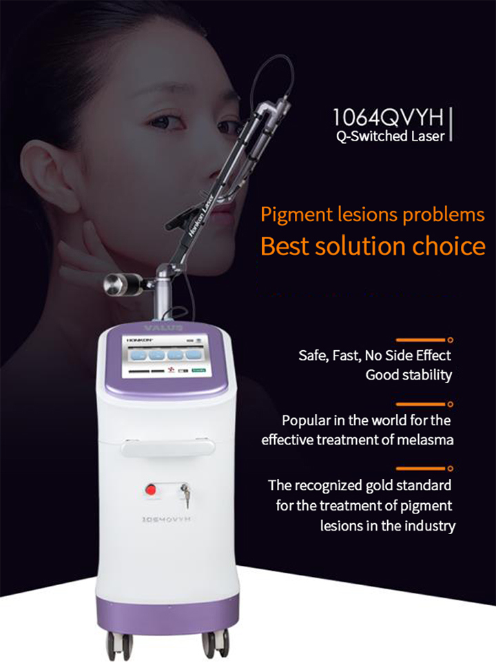 2000mj Laser Tattoo Removal Beauty Machine for Pigment Removal