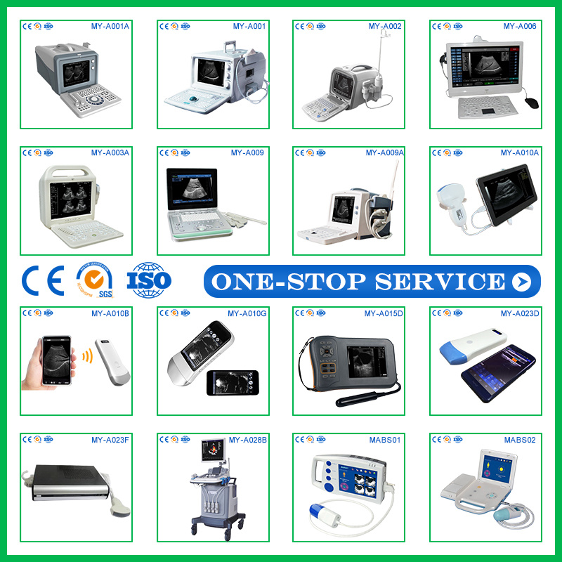 High Quality Medical Ultrasonic Diagnostic Equipment Digital B Ultrasound Machine Price Ultrasound Scanner