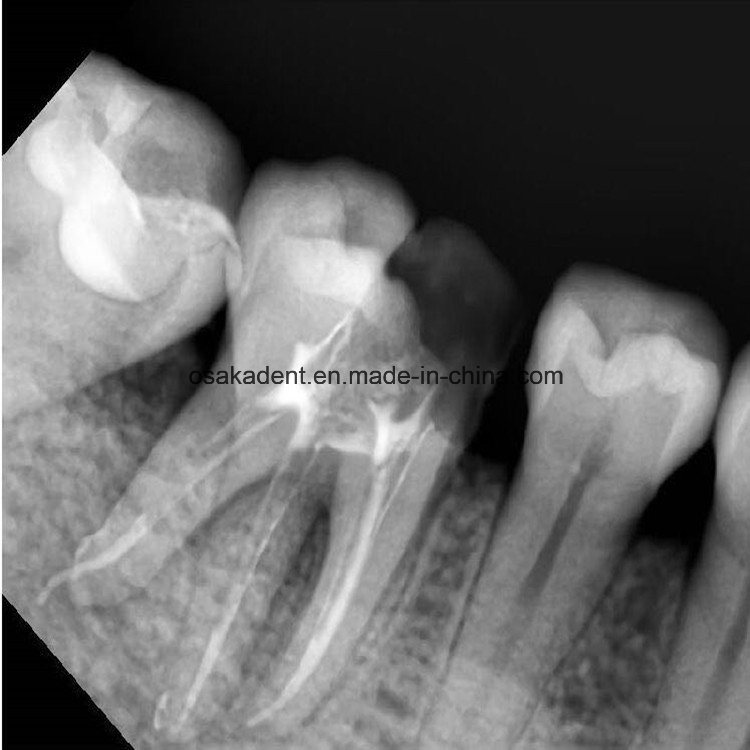 Dental Portable X-ray Unit/ Dental X Ray Unit