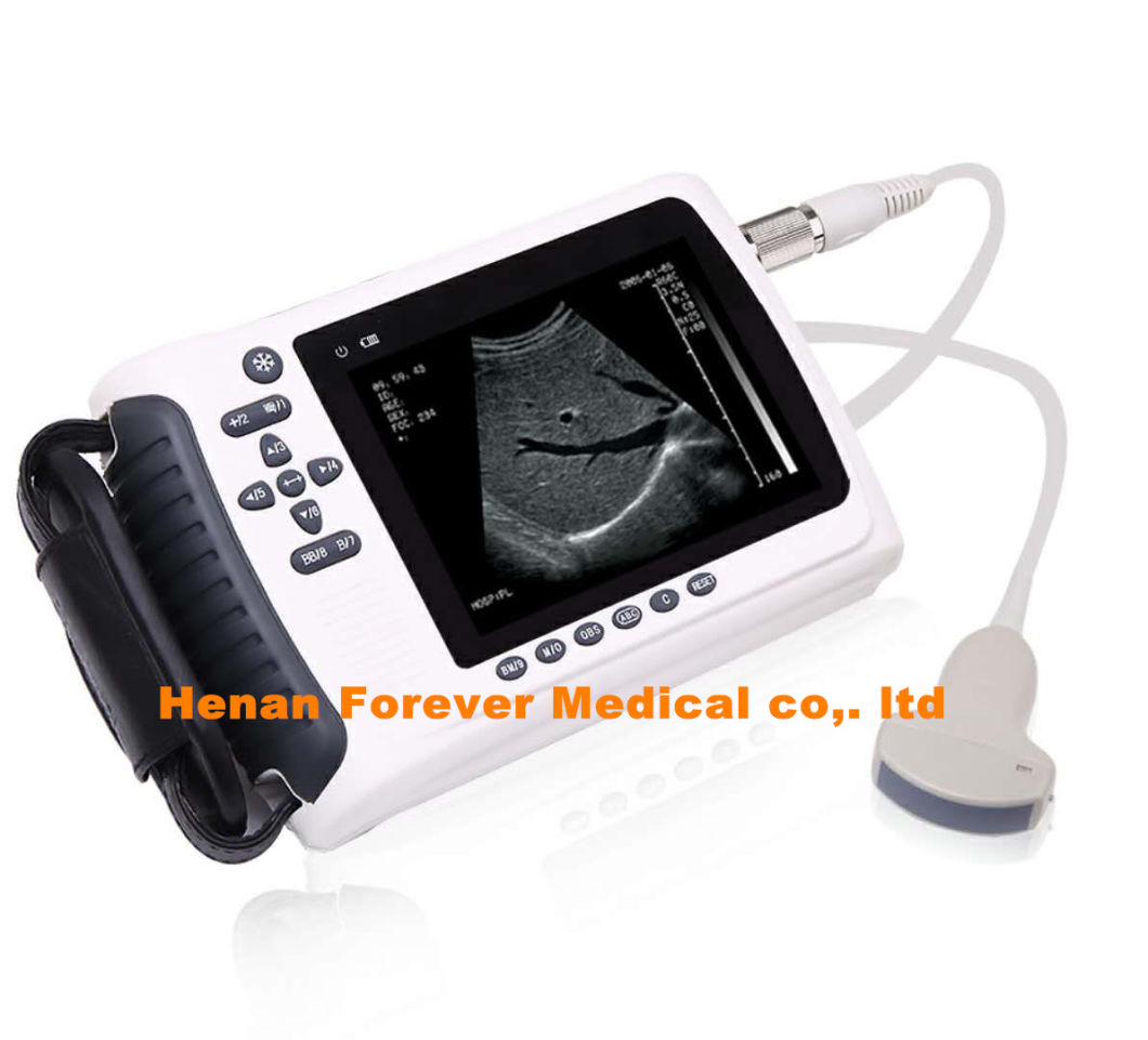 Veterinary Machine Cheap Vet Portable Ultrasound Sheep Pregnancy Scanner