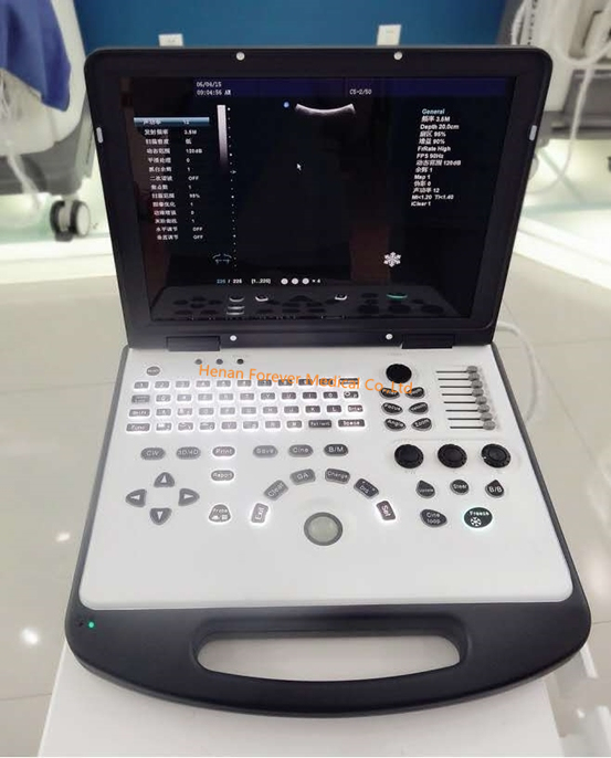 2018 New Product Color Doppler Anesthesia Ultrasound Machines Yj-Au80