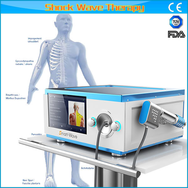 Plantar Fasciitis Eswt Shockwave Therapy System