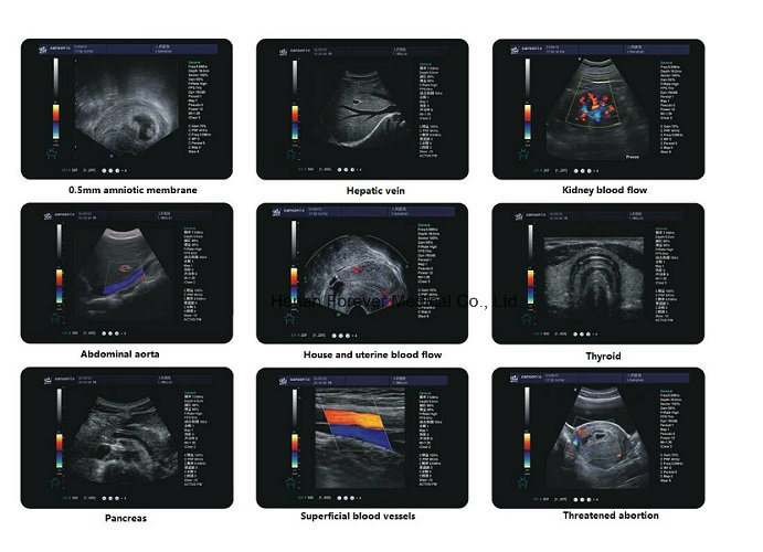 Medical Used Real Time 3D Digital Color Ultrasound Scanner