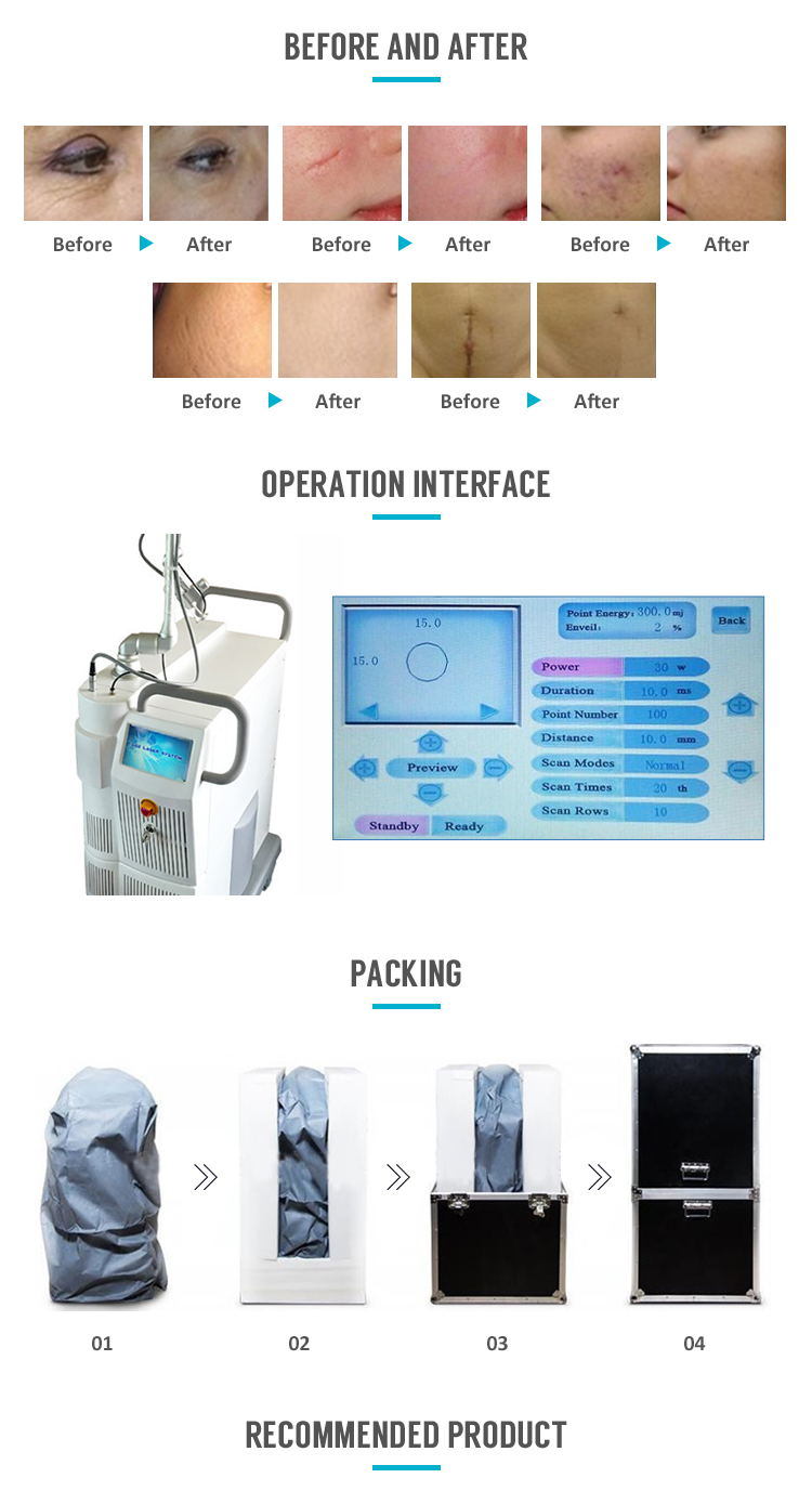 High Power Fractional CO2 Laser Gynaecology Cosmetology Vaginal Tightening Equipment with Medical Ce