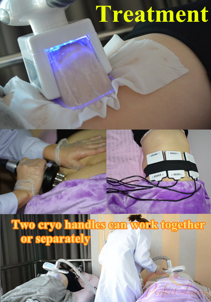 5 in 1 Cryolipolysis Slimming Machine Cavitation RF Lipolaser Two Cryo Handles Can Work Together