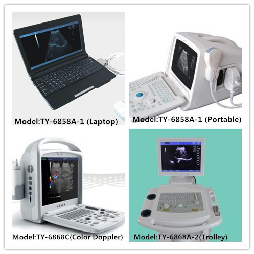 B Mode Laptop Type Mini Ultrasound Scanner Diagnosis Equipment