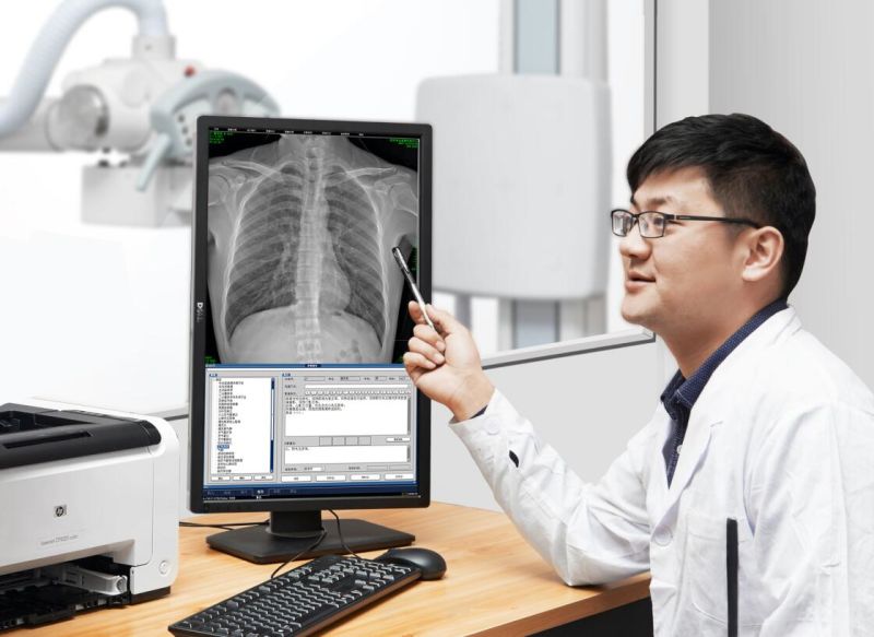 Best Seller X-ray Machine Medical Equipment