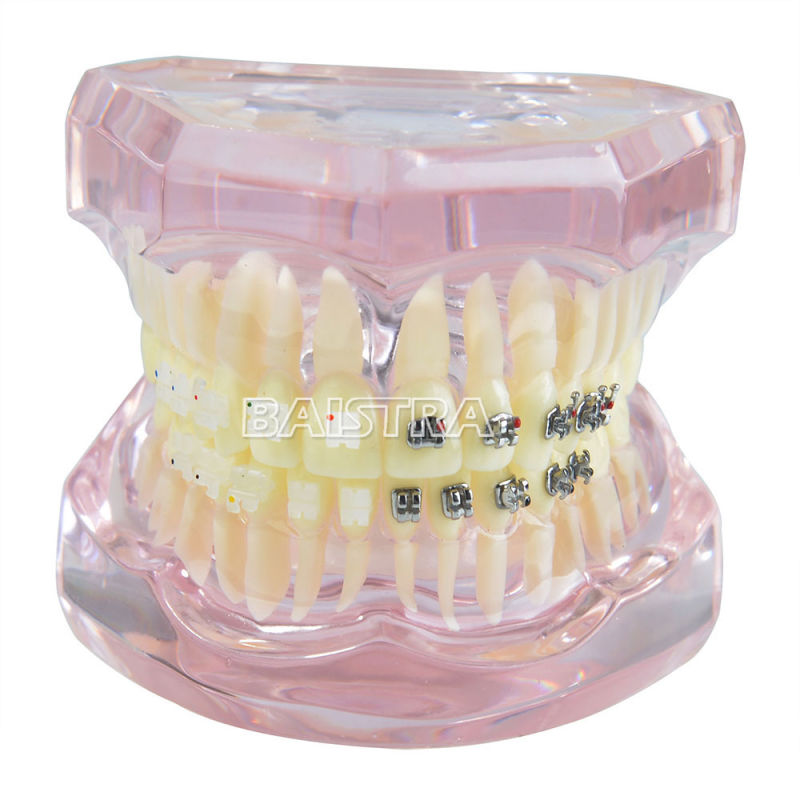 New Arrival Dental Model of Teeth with Ceramic Bracket