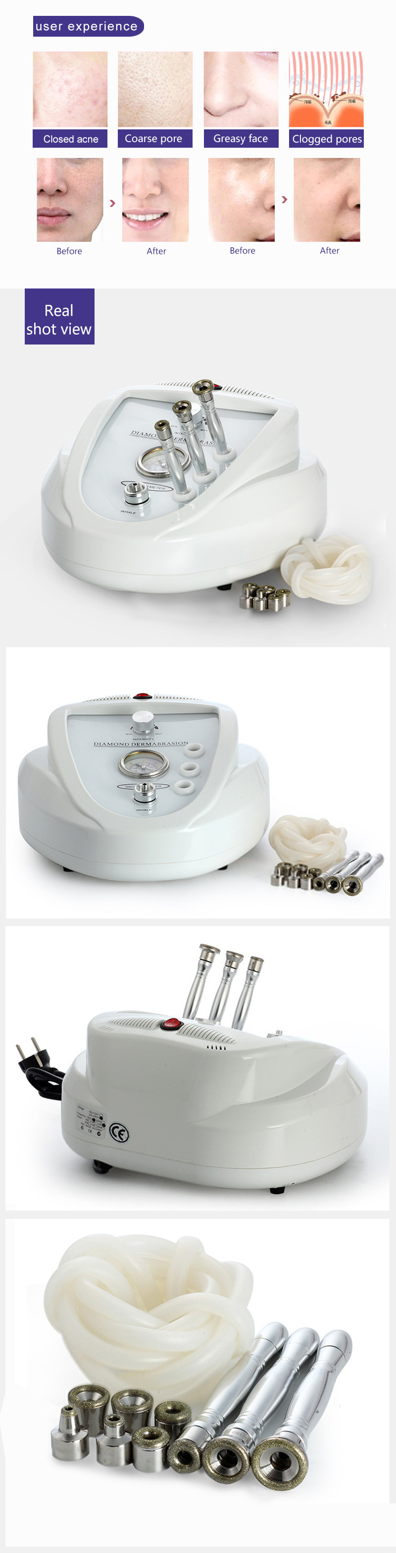 OEM Service Microdermabrasion Beauty Equipment for Peel Facial Deep Moisturization