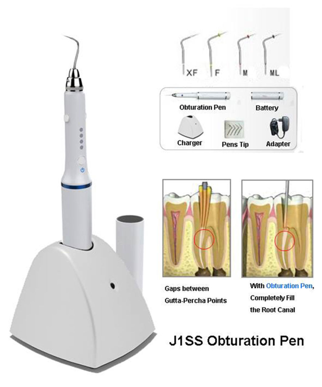 Dental J1ss+E3gg Apex Locator Obturation Endodontic