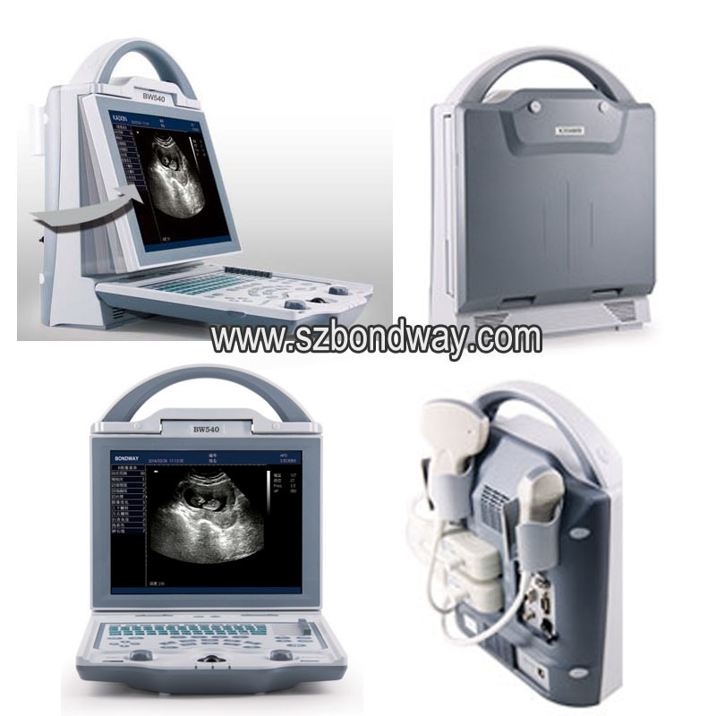 Digital Ultrasound Scan Machine, Portable Ultrasonic Machine, Ultrasonic Transducer, Ultrasound Probe Price, General-Purpose Diagnostic Ultrasound Scanner,