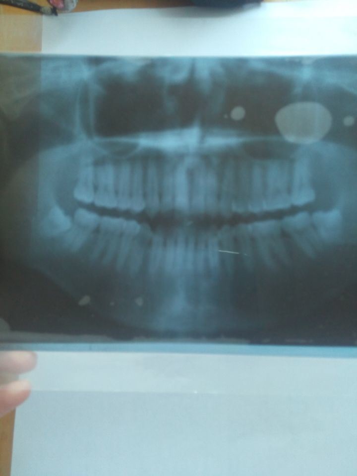 Panoramic Dental Film X-ray Equipment