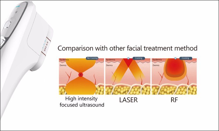 Deep High Intensity Focused Ultrasound Equipment