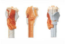 Xy-A6005 Larynx Model- Anatomical Model