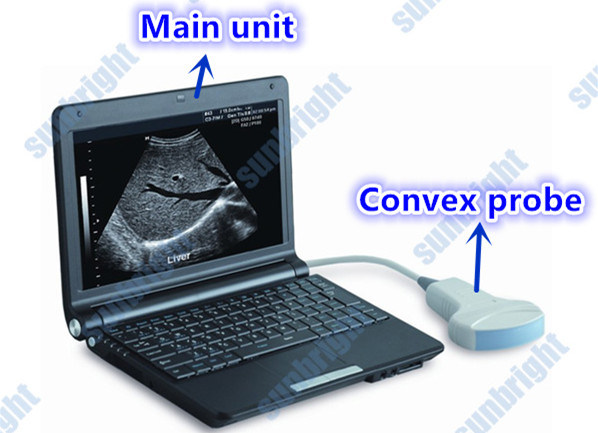 Factory Price Laptop Portable Ultrasound Scanner Sun-806f