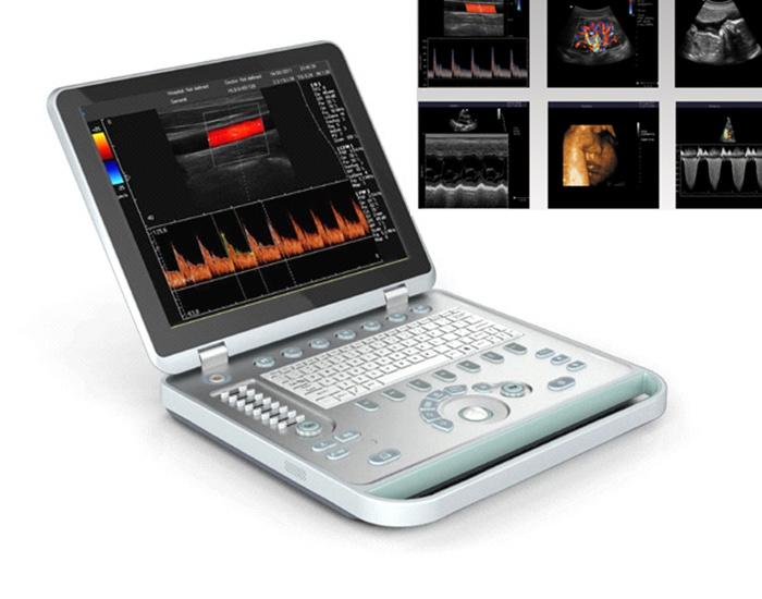 Cheap 3D 4D Clinical Portable Ultrasound Scanner for Obestetrics Cardiac