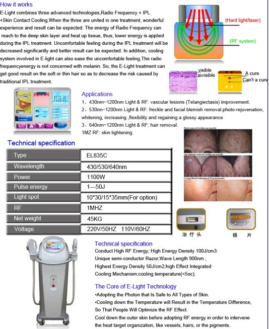 Elight IPL Hair Removal Skin Rejuvenation Beauty Machine