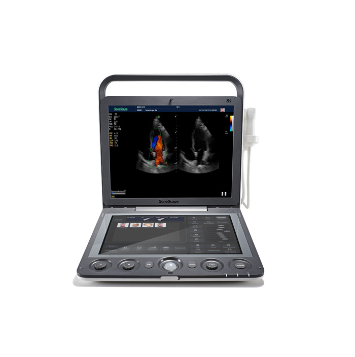 FDA Approved Color Doppler 4D Ultrasound Laptop at Low Cost