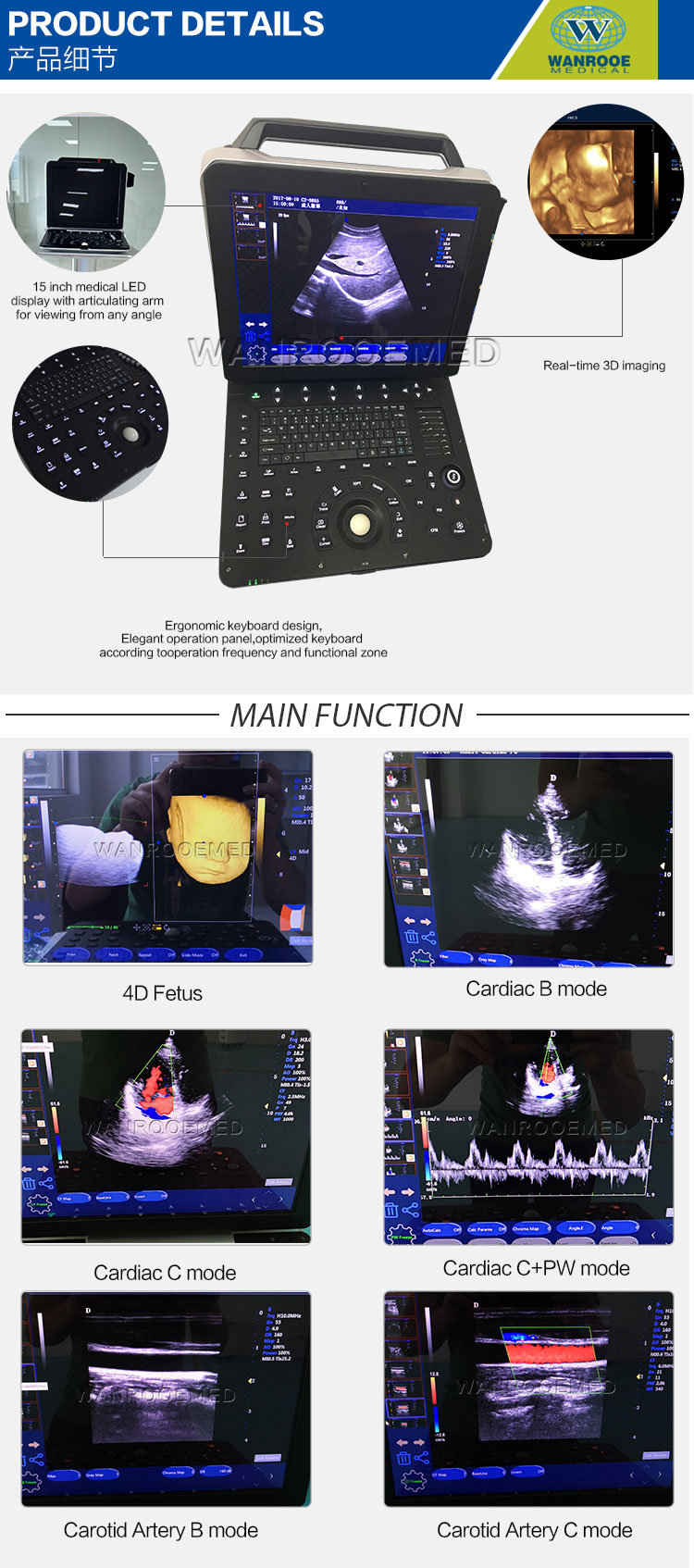 Usc300 Medical Device Laptop Scanner Equipment Portable Color Doppler Ultrasound