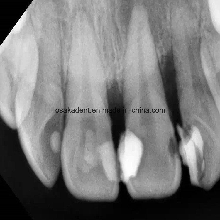 Dental Portable X-ray Unit/ Dental X Ray Unit
