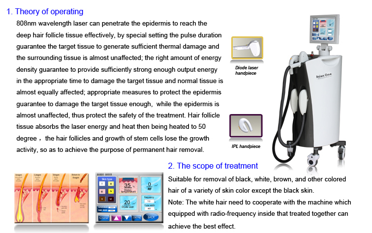 2015 Newest Professional 808nm Hair Removal Diode Laser