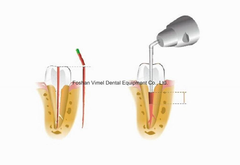 Coxo Dental Gutta Percha Obturation Pen C-Fill a Pack Endodontic