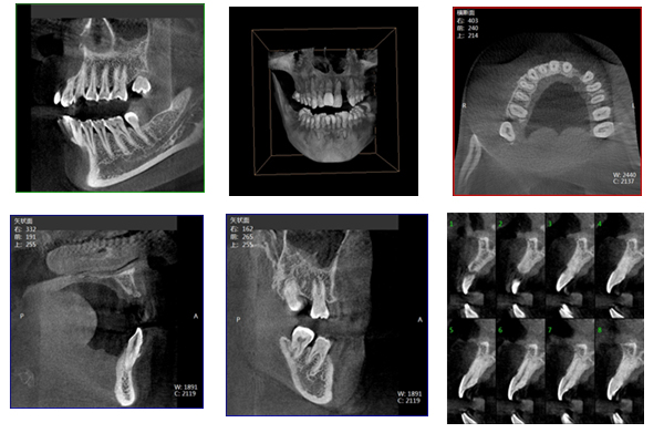 Dental Panoramic Imaging Cbct Scanner (WP3000A)