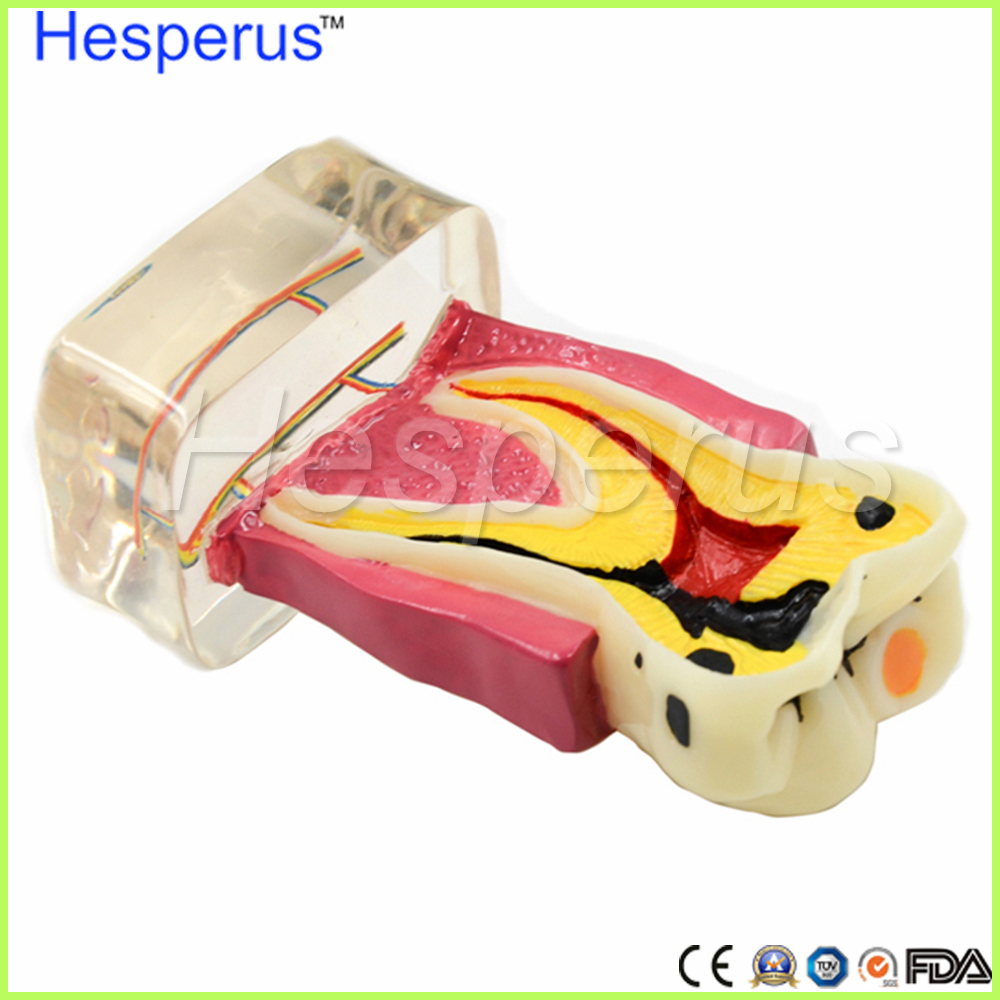 4: 1 Dentist Dental Study Teach Tooth Model Teeth Disease Model