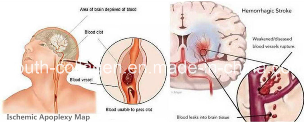 Top Wine, EU Organice Cherry Wine Brut /Sweet Rich SOD Anthocyanin, Amino Acids, Aphrodisiac Anticancer, Antiaging, Blood Tonic, Prevention Ischemic Strok