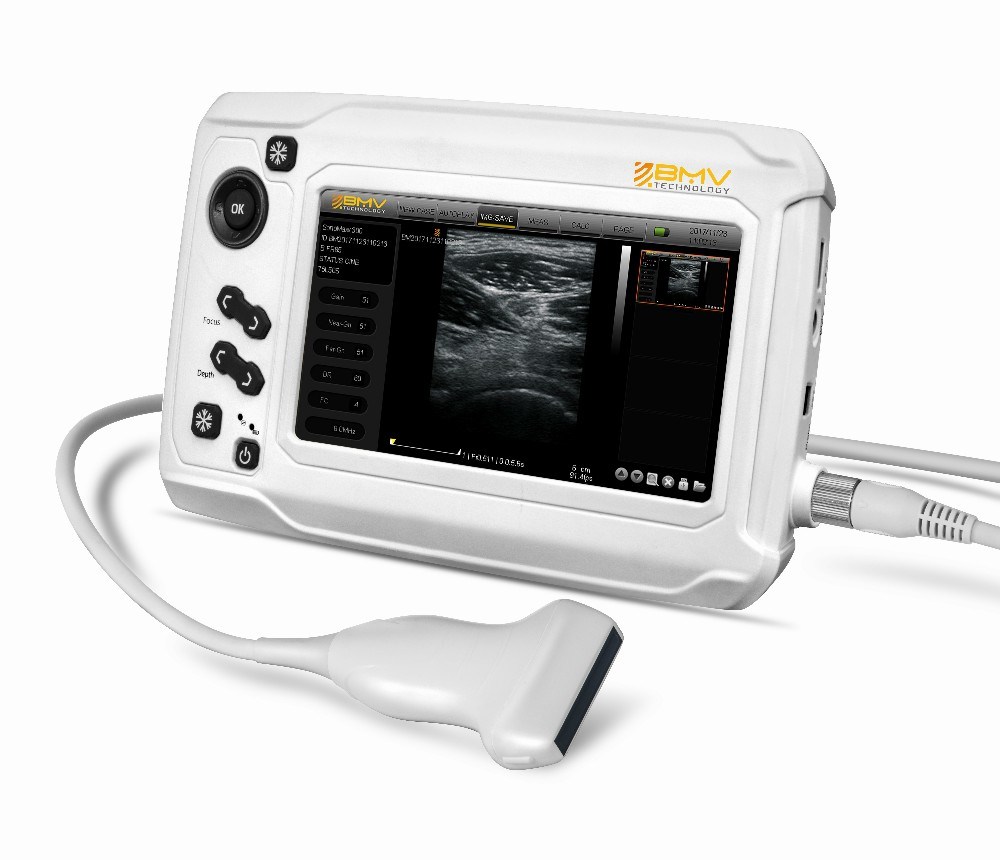 Medical B Ultrasound Machine Full Digital Touch Screen Pregnancy Imaging Scanner