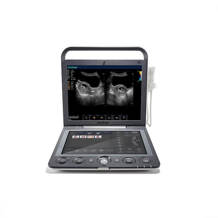 FDA Approved Color Doppler 4D Ultrasound Laptop at Low Cost