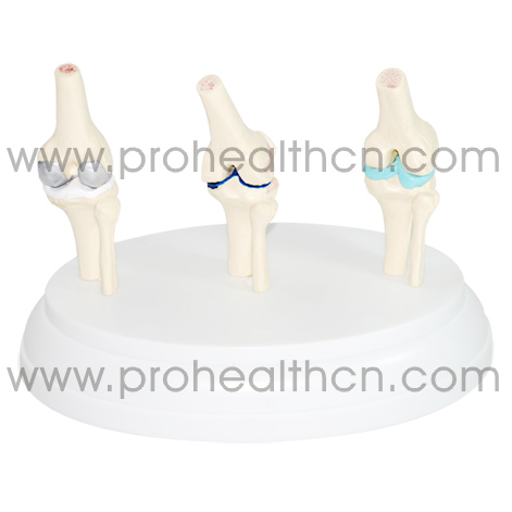 Anatomical Knee Joint Model For Medical Teaching