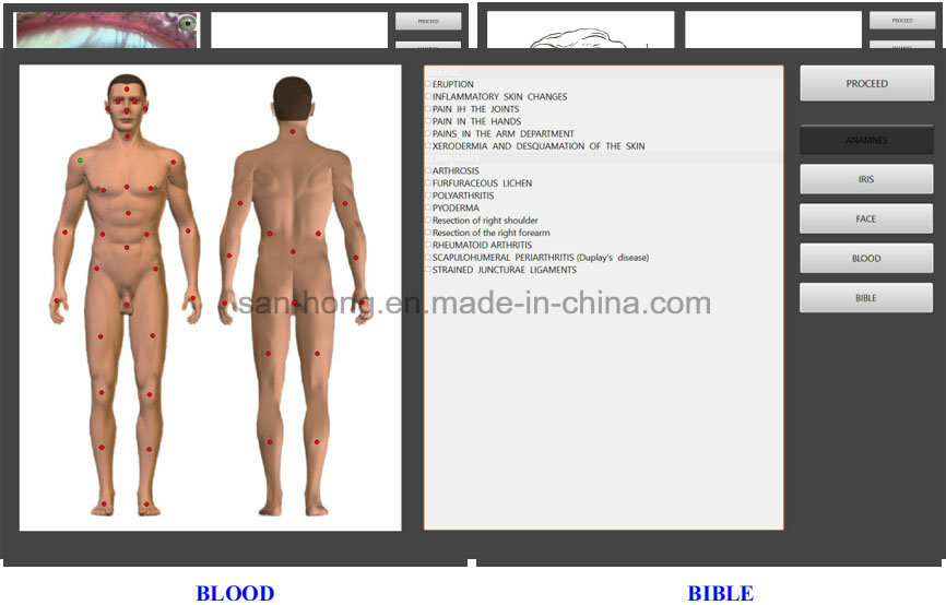 Professional Repair Treatment Function Biophilia Health Analyzer Machine Diagnostic Scanner