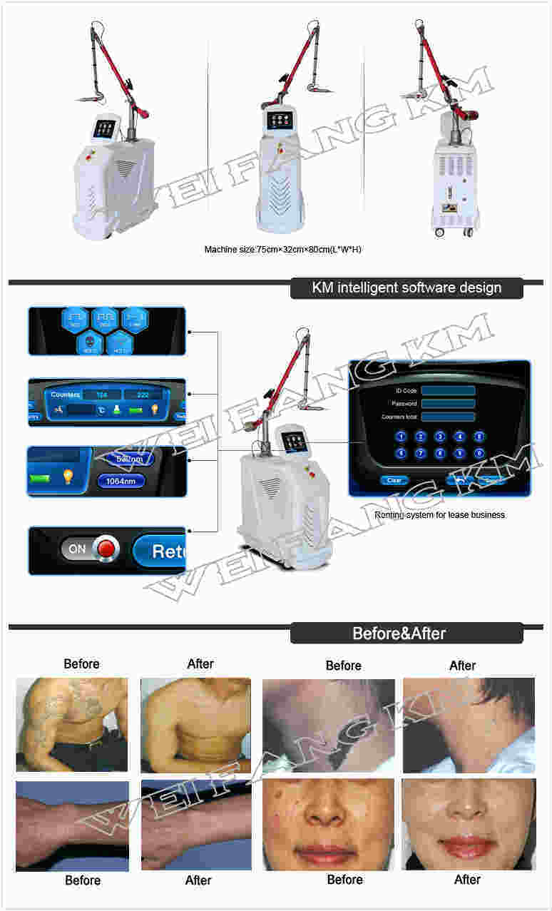 Multifunction Pigment Removal Skin Rejuvenation Tattoo Removal Laser Machine China Laser