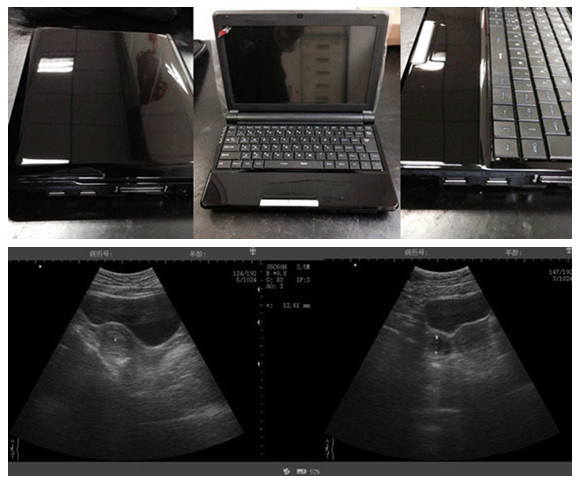 B Mode Laptop Type Mini Ultrasound Scanner Diagnosis Equipment